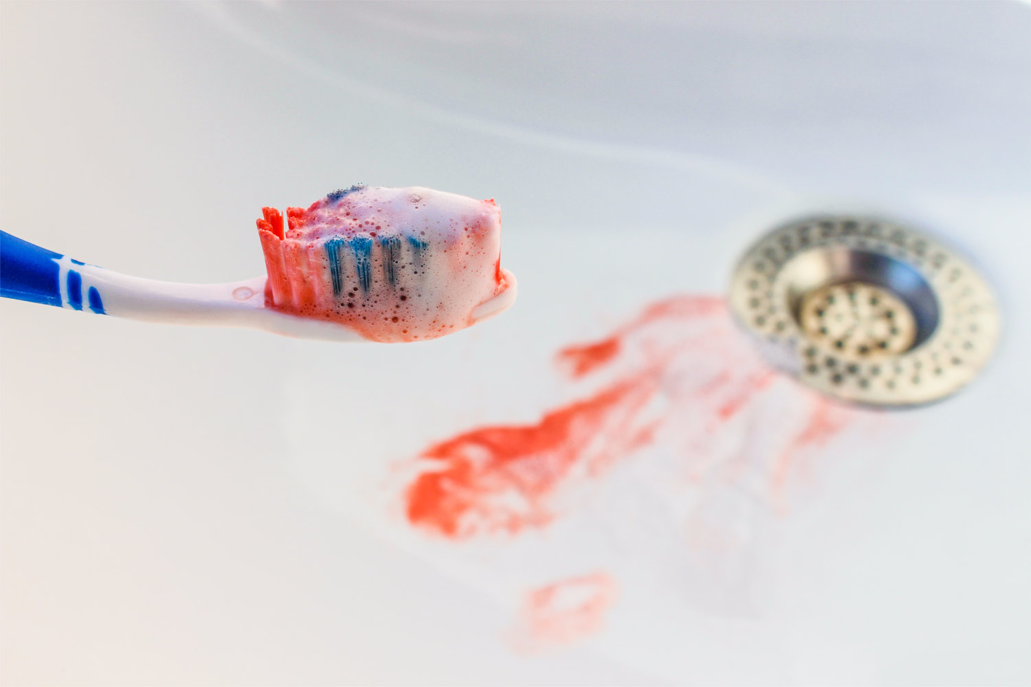 A toothbrush with blood and toothpaste foam over a sink with blood from gum disease